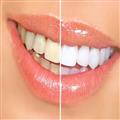 علل تغییر رنگ دندان ها و راههای سفید کردن آنها