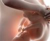کاهش مصرف کربوهیدرات باعث نارسایی‌های جنینی می‌شود