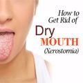 10 روش موثر برای درمان خشکی دهان